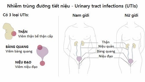 Nhiễm trùng đường tiết niệu