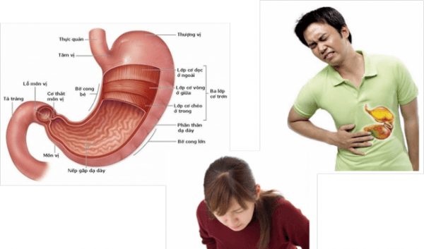Đau vùng thượng vị có thể là dấu hiệu cảnh báo bệnh dạ dày