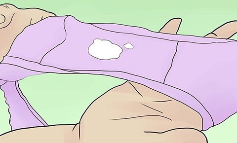 Huyết trắng trước kỳ kinh là hiện tượng sinh lý bình thường