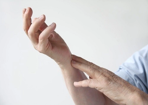 triệu chứng nhồi máu cơ tim: tê ở cánh tay và bàn tay