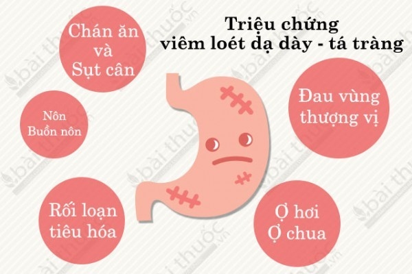 5-trieu-chung-viem-loet-da-day-dien-hinh-1