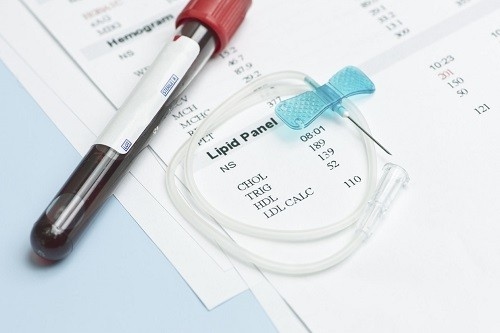 Khi xét nghiệm cholesterol trong máu, các trị số sẽ cảnh báo cho thân chủ những dấu hiệu nguy hiểm nhằm kịp thời điều chỉnh lối sống hoặc phải điều trị để kiểm soát tình trạng rối loạn mỡ máu