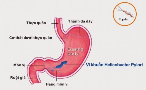 Nên khám viêm thực quản ở Hà Nội tại bệnh viện nào cũng là câu hỏi của nhiều bạn đọc khác đang sống và làm việc tại thủ đô.