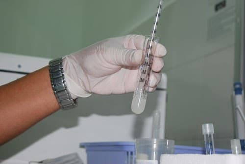 xet-nghiem-tinh-dich-do-het-bao-nhieu-tien-2