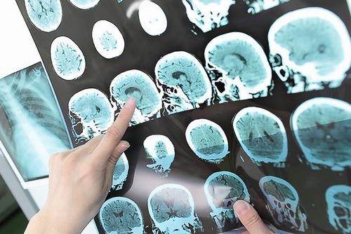 Nếu chấn thương này xảy ra ở trẻ em bạn không nên nhất thiết yêu cầu chụp X-quang hay CT-scan bằng mọi giá.
