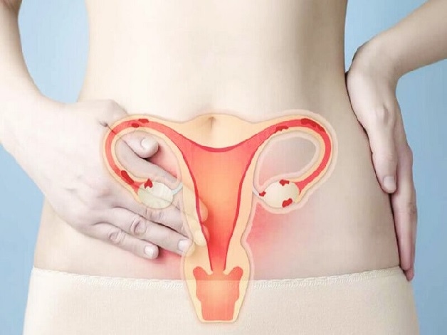Bất thường ở ống dẫn trứng, vòi trứng có thể dẫn đến thai vào tử cung chậm
