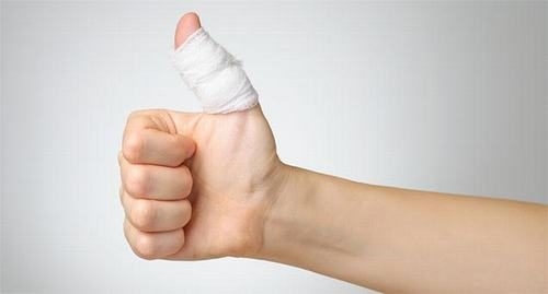 Dấu hiệu bong gân ngón tay cái & Yếu tố làm tăng nguy cơ bong gân
