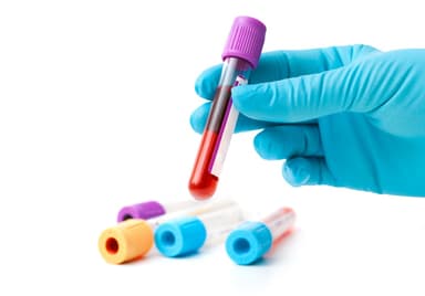 Giải mã chỉ số HgB là gì, 3 thông tin cần biết về HgB