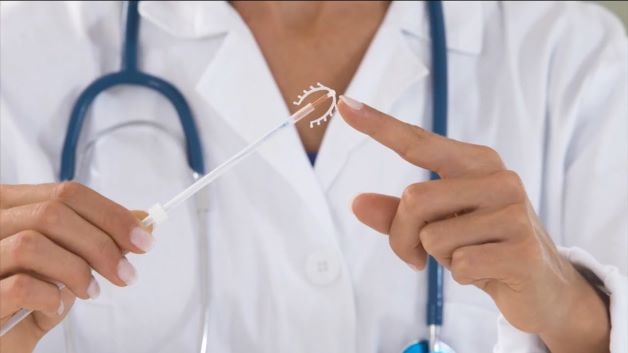 Vòng tránh thai là một loại dụng cụ bằng nhựa nhỏ thường được sử dụng đặt vào tử cung của cơ thể người phụ nữ.