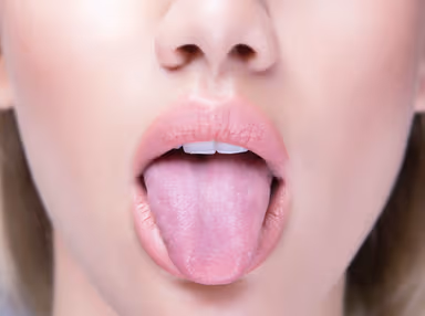 Hình ảnh ung thư miệng: 1 trong 6 loại ung thư thường gặp nhất