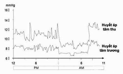Huyết áp dao động nguy hiểm cần được phát hiện sớm và điều trị hiệu quả