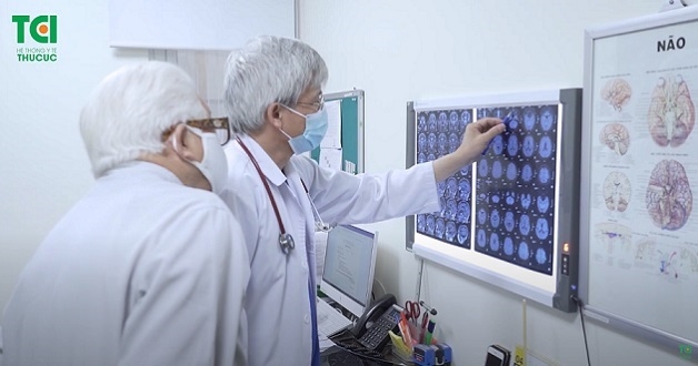 điều trị suy giảm trí nhớ