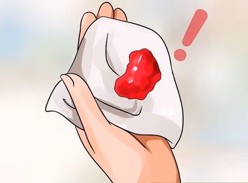 Kinh nguyệt ra nhiều máu đỏ tươi