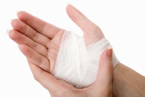 Những điều CẦN LƯU Ý khi Bong Gân Cổ Tay để nhanh khỏi hơn