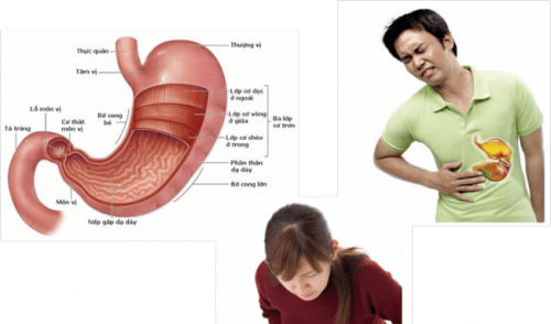 Cảm giác đau vùng bụng là triệu chứng thường gặp khi bị viêm loét dạ dày tá tràng
