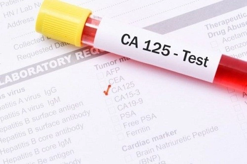 Xét nghiệm máu tìm dấu ấn ung thư CA 125 giúp chẩn đoán sớm ung thư buồng trứng