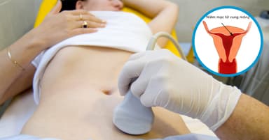 Góc giải đáp cho nữ giới: Niêm mạc tử cung mỏng có sao không?