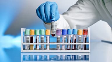 Ý nghĩa các chỉ số và chi phí xét nghiệm chức năng thận