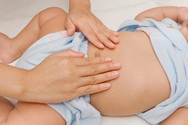 Những trẻ mắc chứng phình đại tràng thường có các dấu hiệu đặc trưng như táo bón, nhiều trẻ không tự đại tiện được mà cần phải thụt tháo thường xuyên, bụng trướng,....