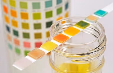 Xét nghiệm nước tiểu có phát hiện bệnh lậu không?