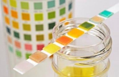 Xét nghiệm nước tiểu có phát hiện bệnh lậu không?