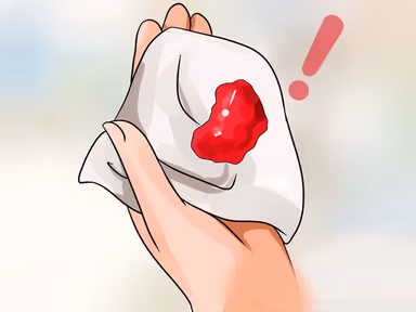 Phân đen có máu – Khám ngay trước khi quá muộn