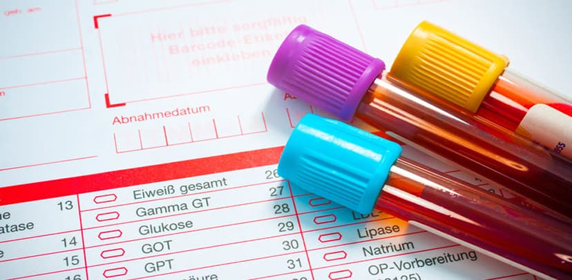 Chỉ số ggt bao nhiêu là cao? Chỉ số GGT tăng cảnh báo bệnh gì?