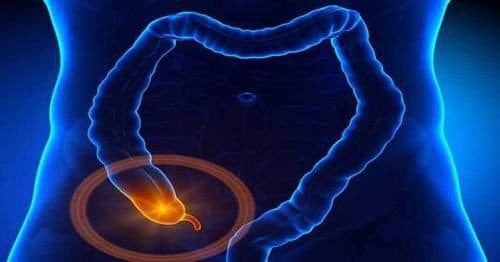 Hình ảnh viêm ruột thừa trên siêu âm