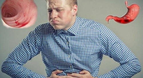 Xuất huyết dạ dày có chữa được không là thắc mắc chung được nhiều người đặt ra