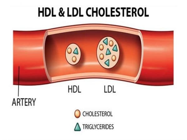 LDL cholesterol là một loại lipoprotein mang cholesterol trong máu, đây là chỉ số không tốt