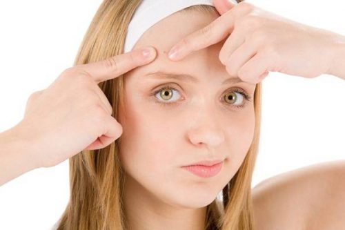 Tuổi dậy thì, các bé gái thường thấy mụn xuất hiện nhiều.
