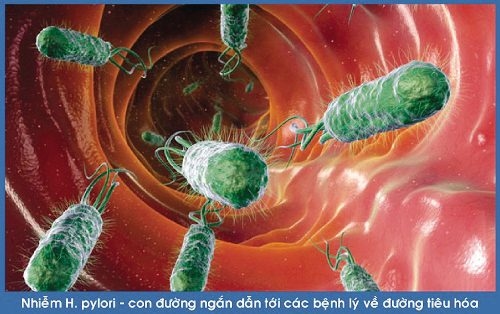Vi khuẩn HP có thể tồn tại lâu trong dạ dày và gây bệnh
