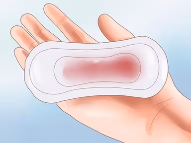 Áp lạnh xong bị chảy máu có sao không?