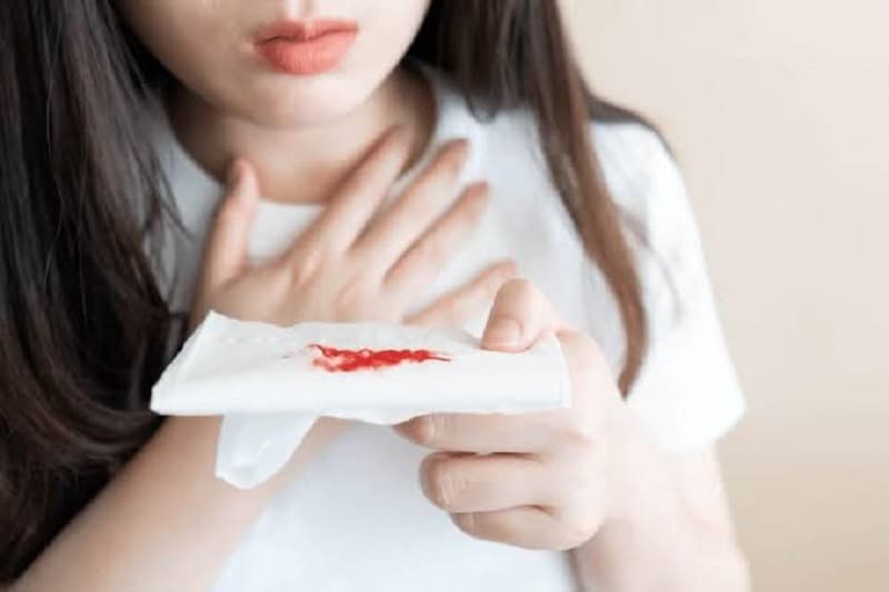 Ho ra máu có thể là dấu hiệu cảnh báo ung thư phổi