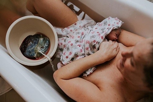 Phương pháp sinh con thuận tự nhiên đang được một bộ phận các mẹ bầu tìm hiểu và áp dụng
