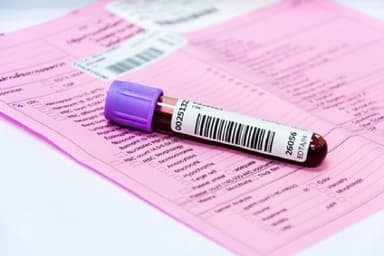 Xét nghiệm cyfra 21 – 1 là gì?