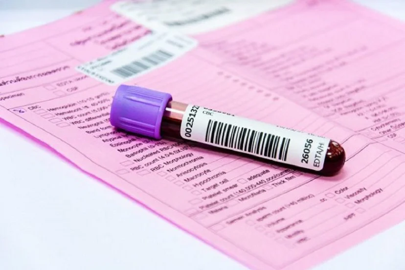 Xét nghiệm cyfra 21 – 1 là gì?