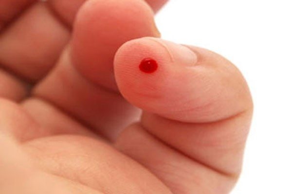 Ung thư không lây qua đường máu