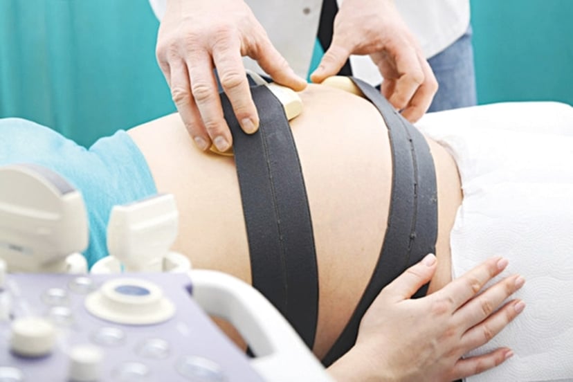 tim thai và cơn co tử cung bằng monitor sản khoa