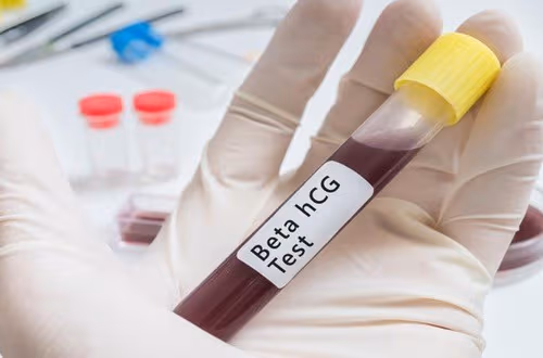 Xét nghiệm máu phát hiện thai bao nhiêu tiền?