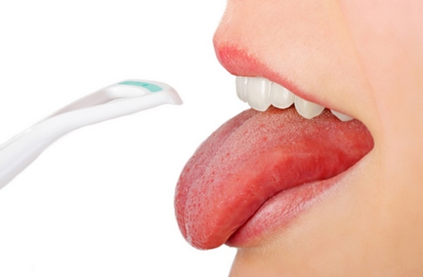 các phương pháp điều trị ung thư lưỡi