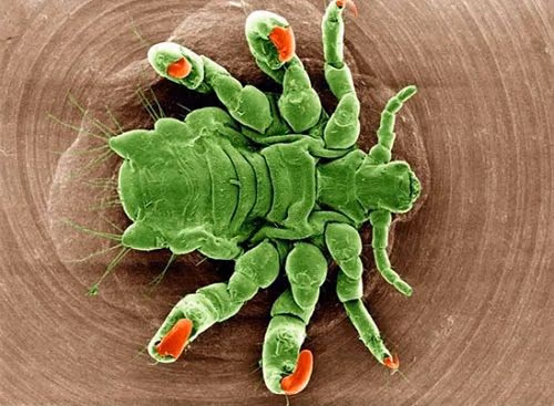 Các dấu hiệu nhận biết bệnh rận mu