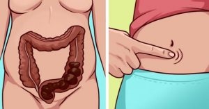 Khi quá 3 ngày chưa đi ngoài hoặc đi ngoài dưới 3 lần trong một tuần có thể gọi là mắc bệnh táo bón.