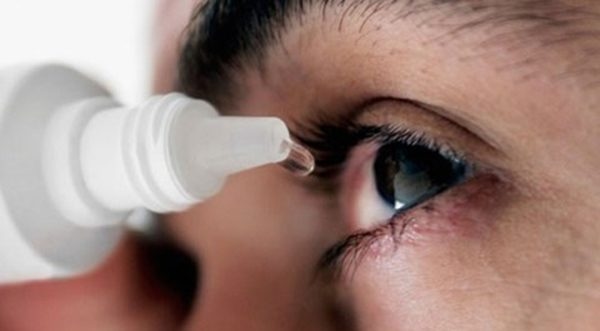 Đau mắt đỏ do virus thuộc nhóm virus Adenos gây ra.