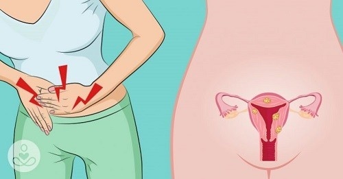 Ung thư cổ tử cung là bệnh ung thư phụ khoa phổ biến ảnh hưởng nhiều nhất đến cơ quan sinh sản ở nữ giới