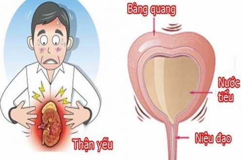 Uống nhiều rượu bia có thể gây ảnh hưởng nghiêm trọng đến chức năng thận