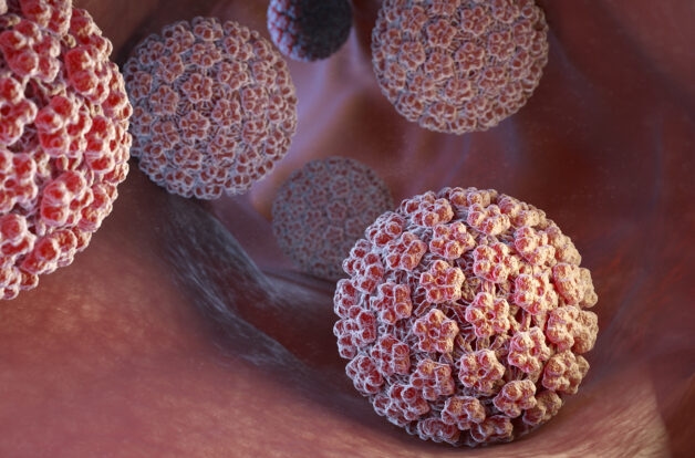 Ung thư cổ tử cung hình thành thường là do Human Papillomavirus (HPV).