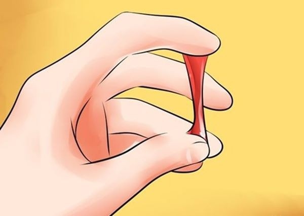 Xuất huyết âm đạo bất thường là một trong những triệu chứng ung thư cổ tử cung điển hình