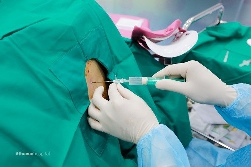Gây tê ngoài màng cứng để giảm đau trong đẻ là phương pháp phổ biến, được nhiều mẹ bầu lựa chọn