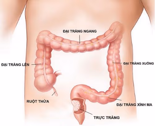 Trực tràng là đoạn ruột thẳng dài khoảng 11-15cm nằm ở cuối đại tràng, có chức năng co bóp và hỗ trợ đưa chất thải từ cơ thể ra bên ngoài